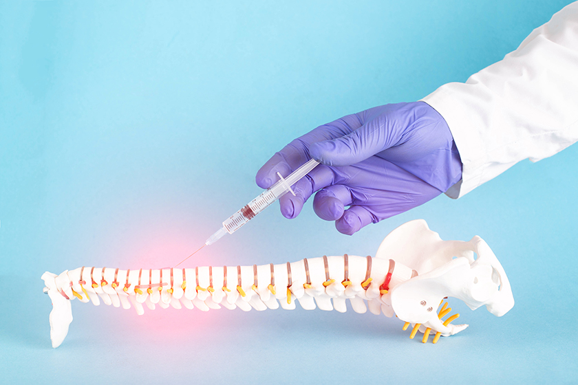 Hand wearing surgical glove holding syringe above model of human spine