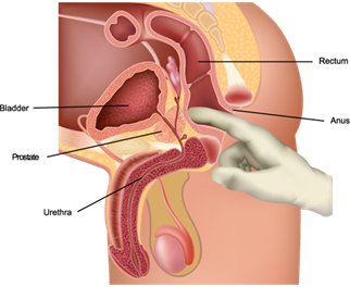Urology diagram of prostate examination
