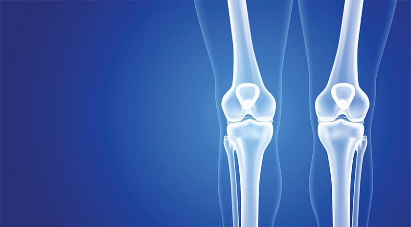 X-ray of knees image for orthopaedic GP Education event