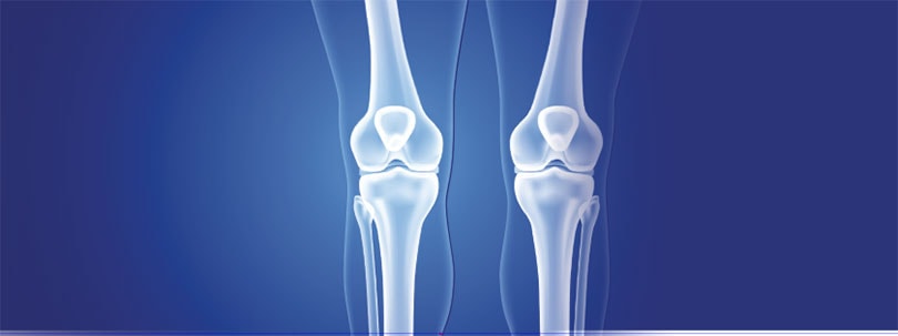 X-ray vision illustration showing leg bones