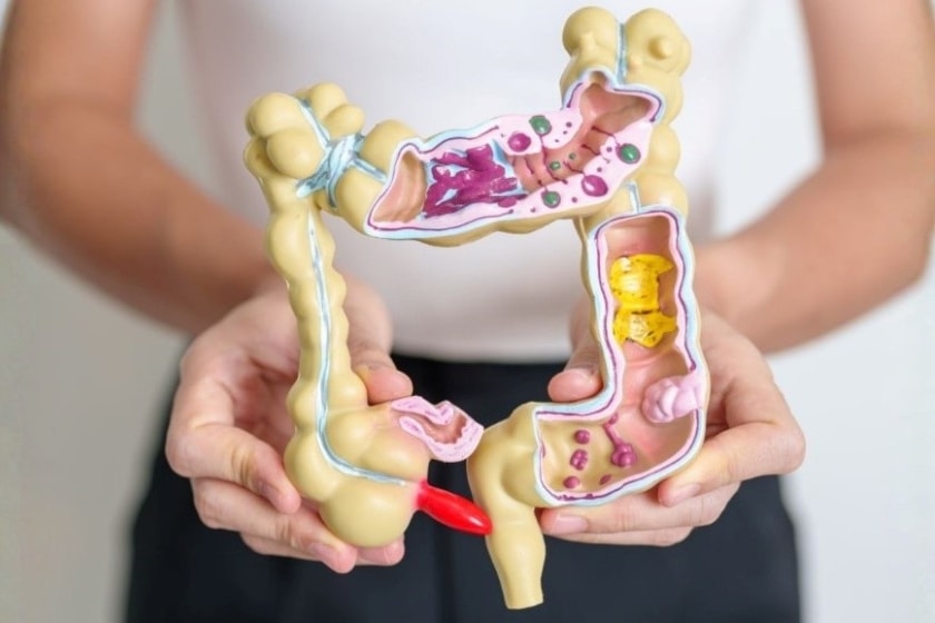 A person holding a medical model of the human large intestine and colon, shown in cross-section with different digestive contents and intestinal features visible inside.