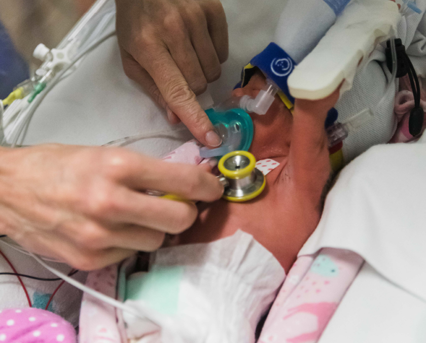 Baby in the Neonatal Unit wearing CPAP