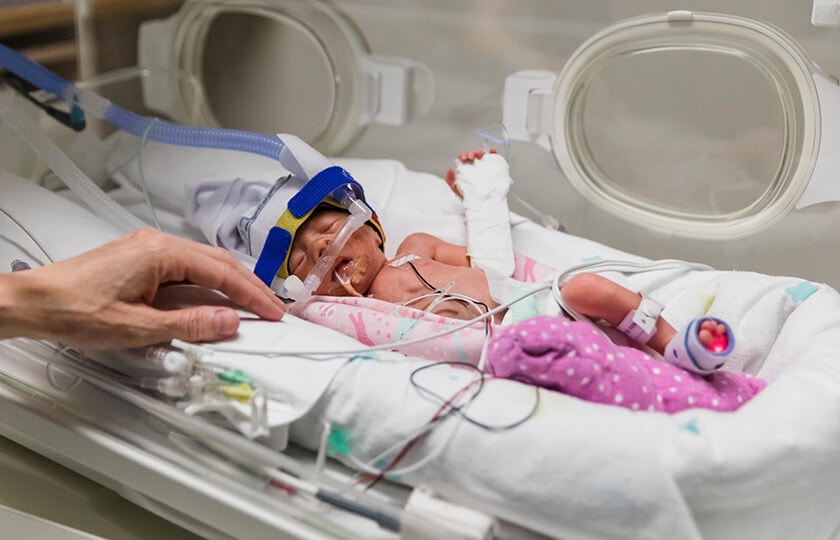 Preterm baby receiving medical care